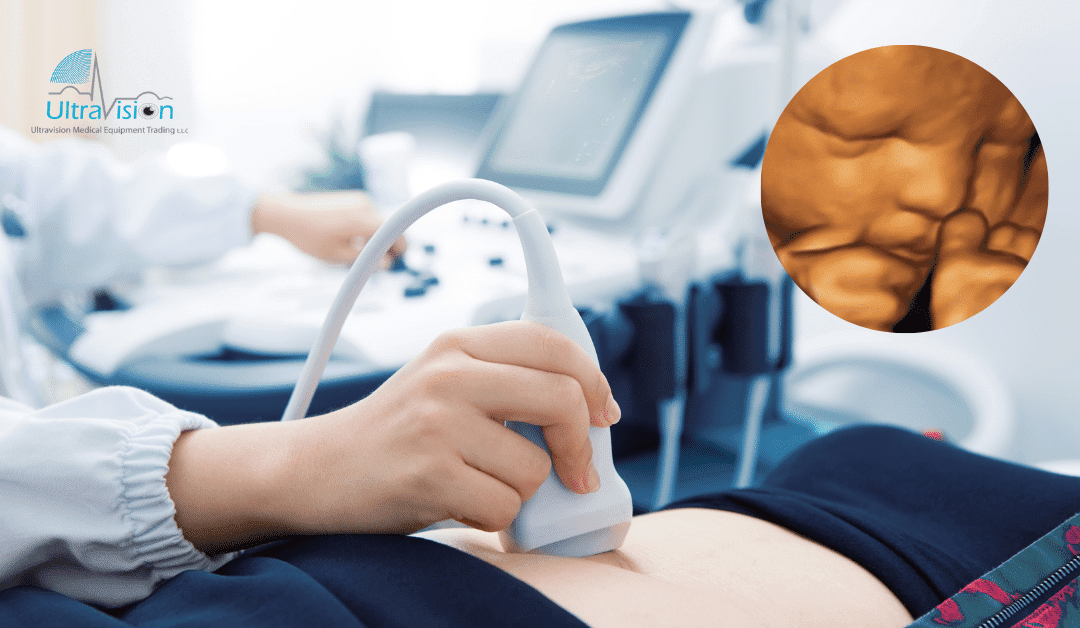 4D Ultrasound and 5D Ultrasound: Revolutionizing Maternal & Fetal Care
