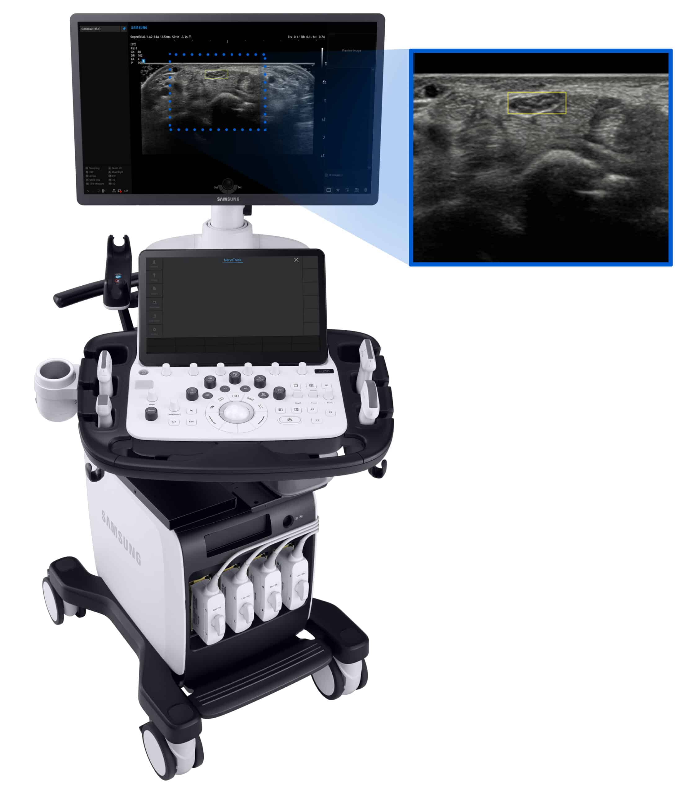 Samsung V8 Ultrasound