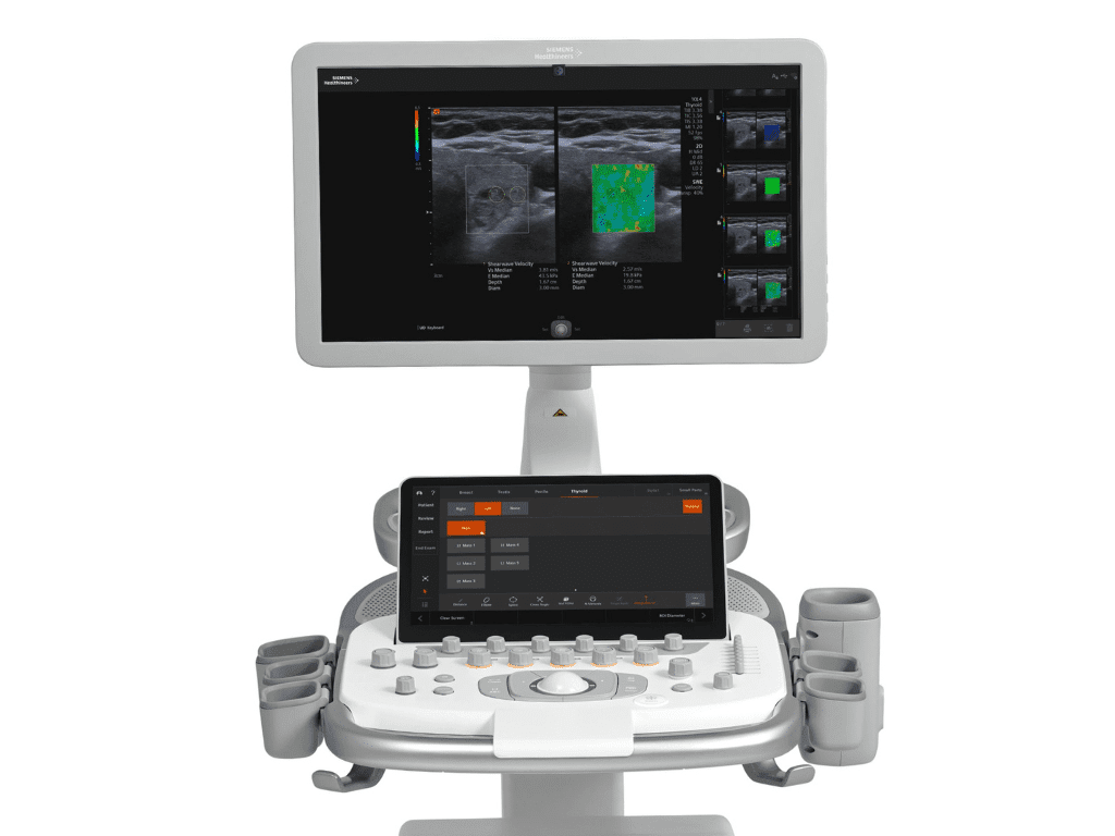 Siemens Acuson Redwood Ultrasound