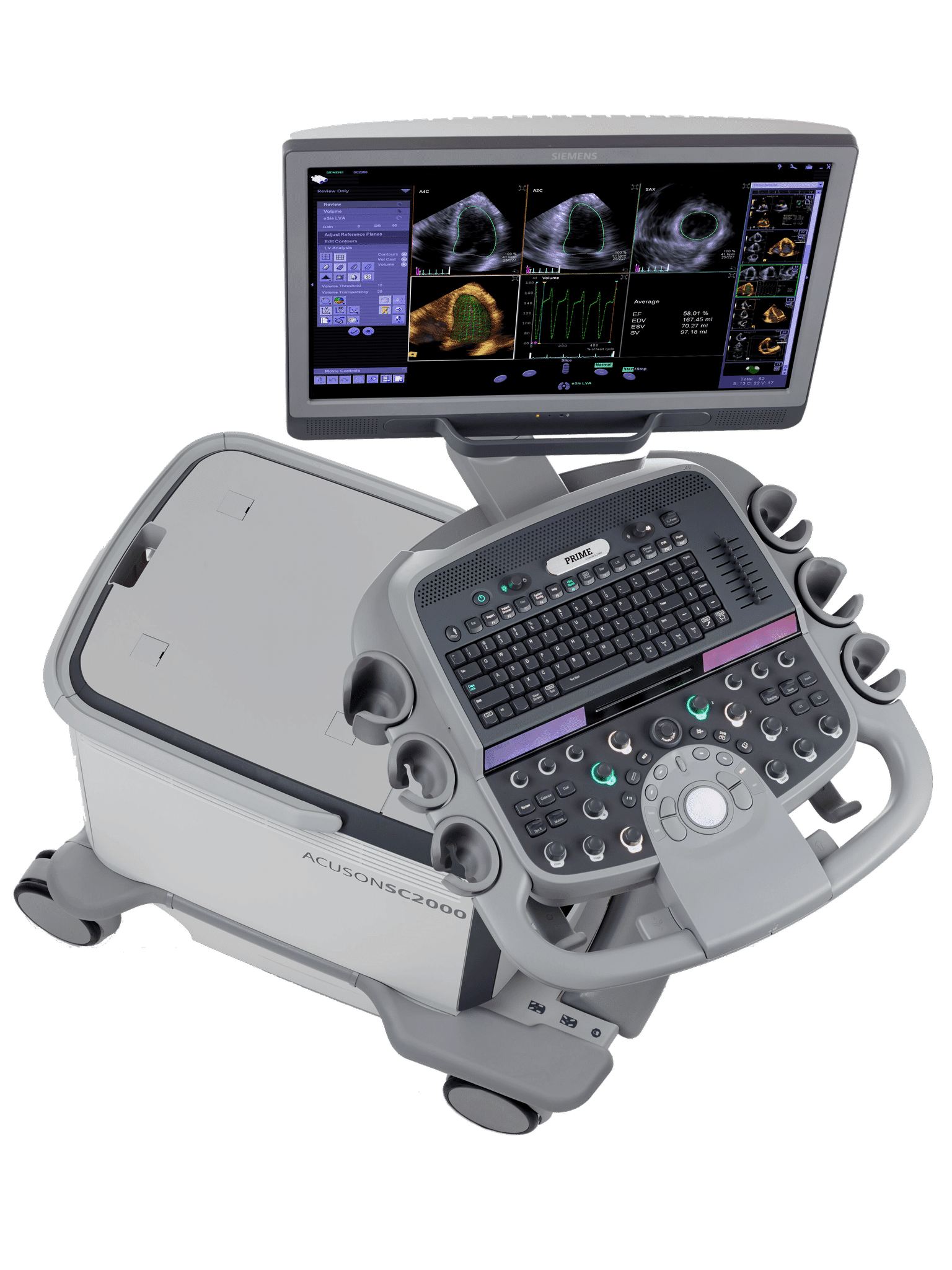 Siemens SC2000 Ultrasound